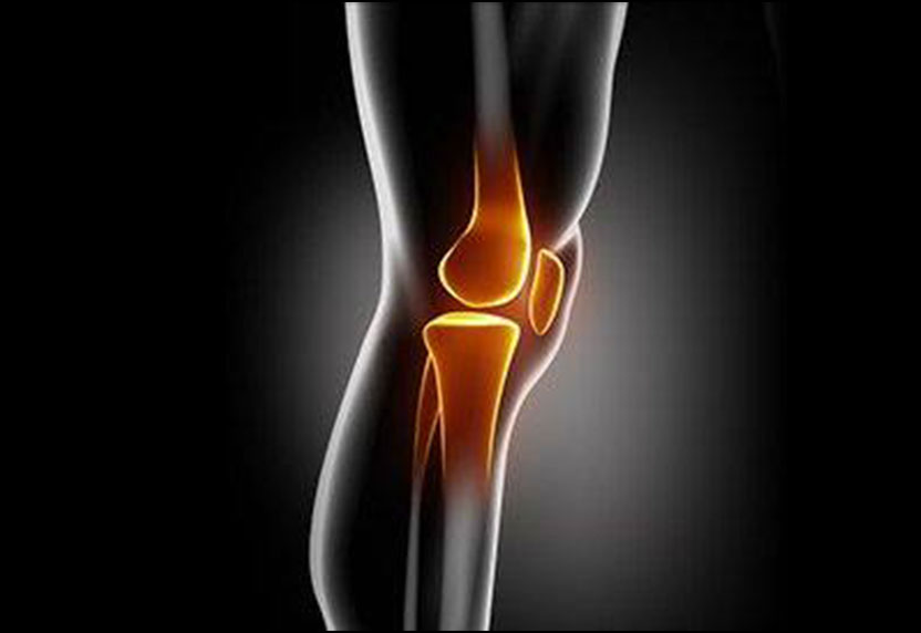 High Dietary Phytochemical Index Lead to Decreased Risk of Knee Osteoarthritis