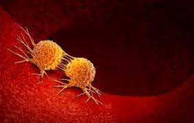 Cancer Less Heritable Than Previously Thought